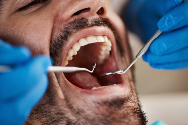 Best Chipped Tooth Repair Near Me  in Ogden, UT